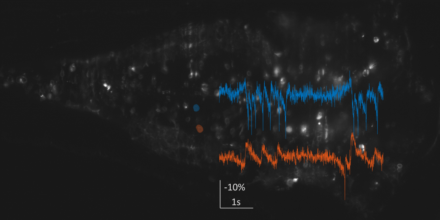 red and blue jagged lines from a cell recording